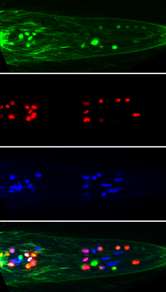 Fluorescent neurons in C. elegans