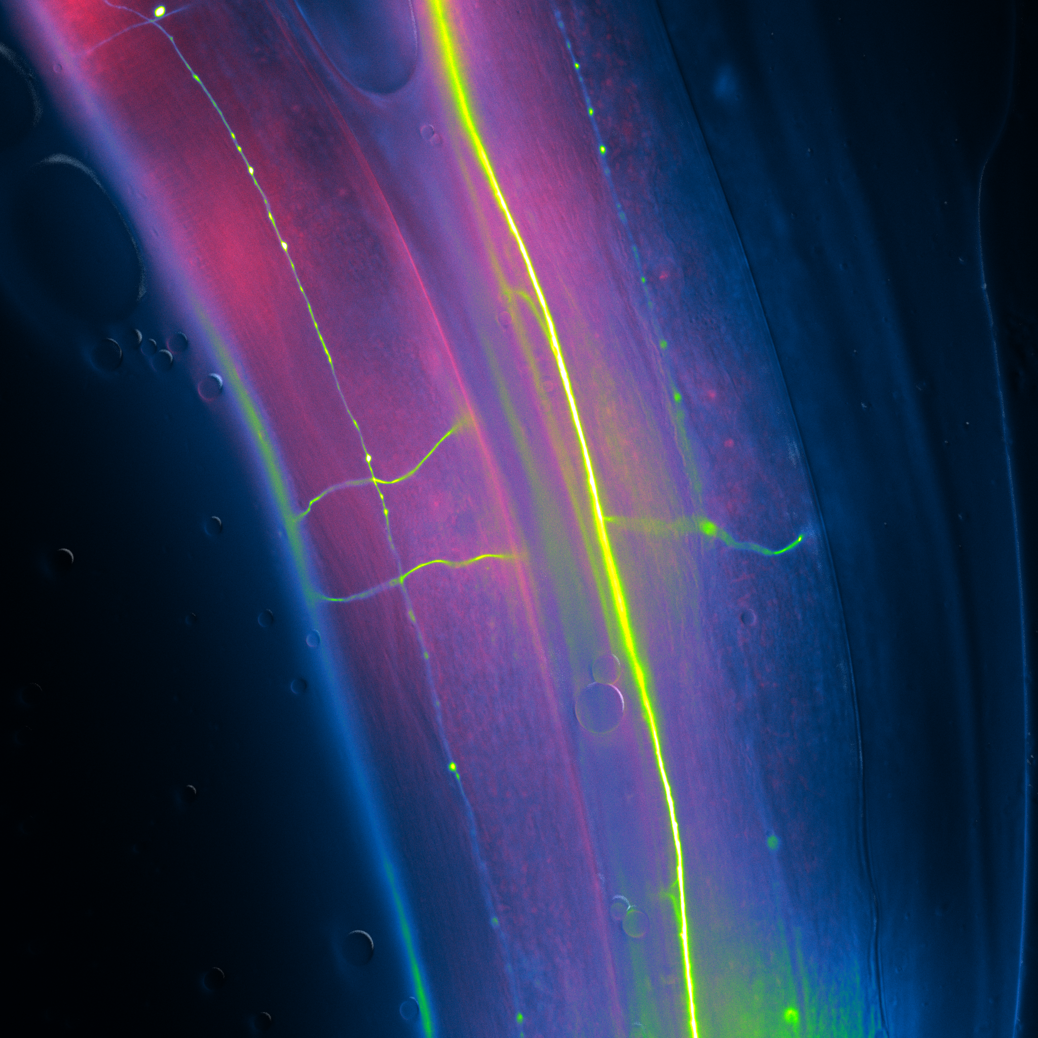 Fluorescent neurons in C. elegans